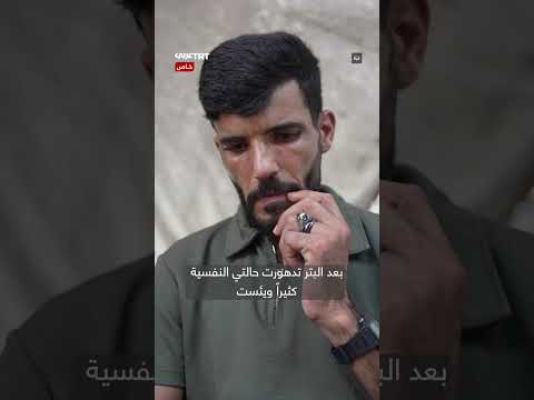فلسطيني يعمل في الحلاقة لإعالة أسرته بعد فقد ساقه ووالده